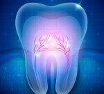 Dantų šaknų kanalų beskausmis gydymas ir pergydymas