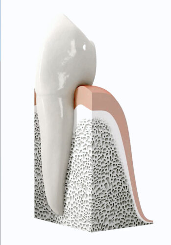 Danties implantas – lyg nuosavo danties šaknis
