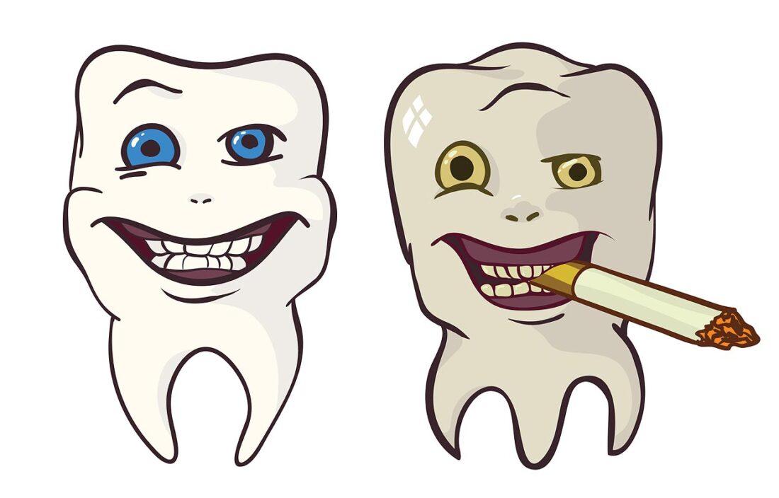 Dantų spalvos keitimosi priežastys