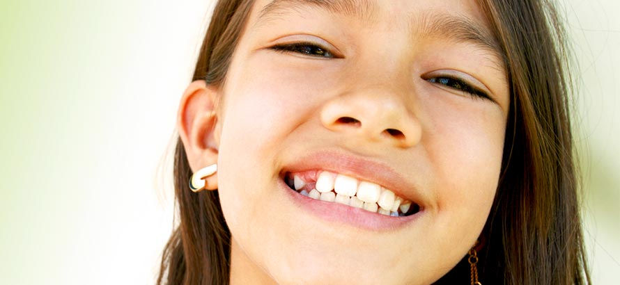 Paauglių dantų problemos