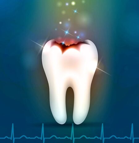 Profilaktinės dantų apžiūros svarba