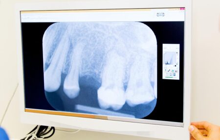 Dantų rentgeno nuotraukos