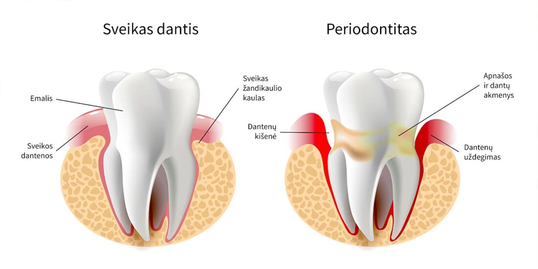 Profilaktinė dantų apžiūra
