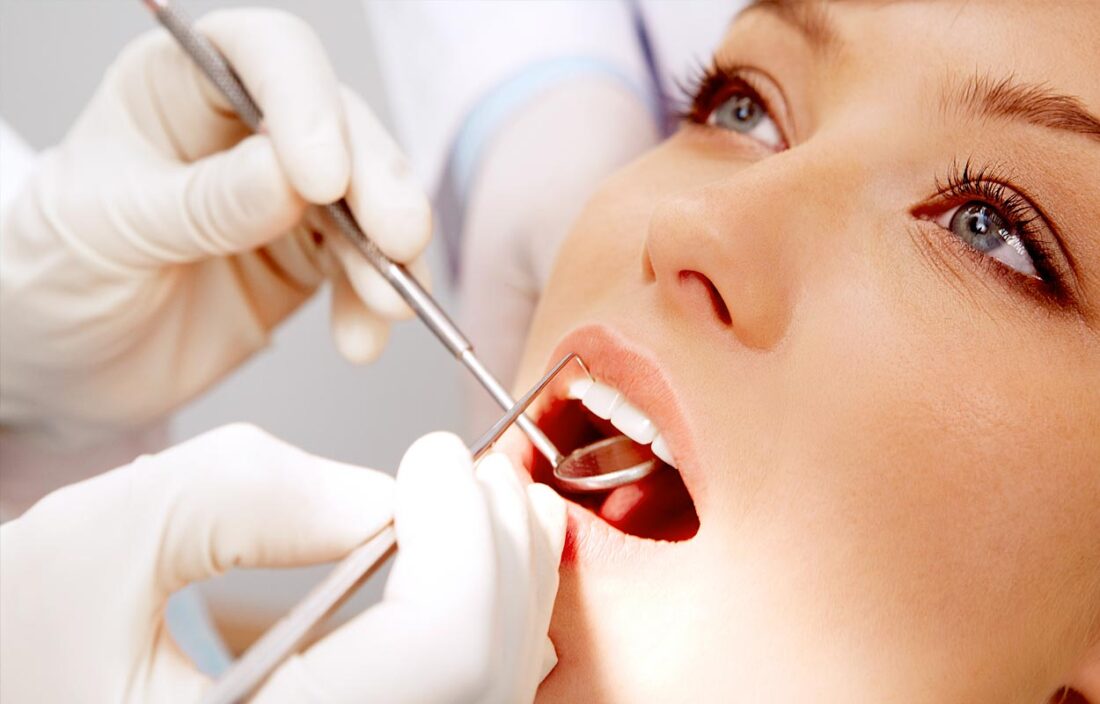 Dantų protezavimo būdai