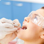 Burnos higiena dantų ėduoniui taria griežtą NE